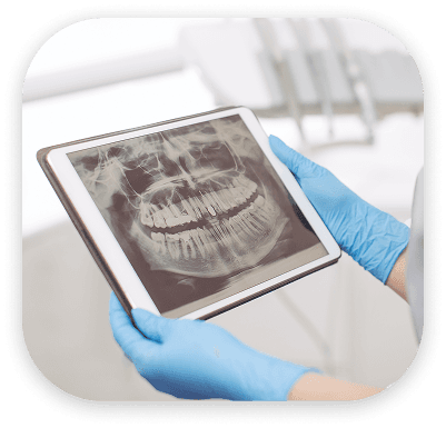 ก่อนและหลัง